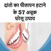 Teeth whitening दातो का पीलापन