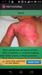 First Aid APK download