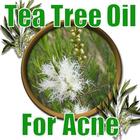 Tea Tree Oil for Acne icône
