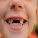 Repairing The Front Tooth APK