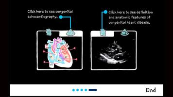 Echo CTT screenshot 1