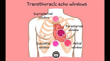 Echo CTT تصوير الشاشة 2