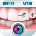 Before and After braces Photo biểu tượng