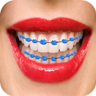 Amazing Smile Braces icône