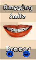 Amazing Smile Braces Plakat