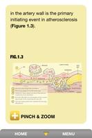 برنامه‌نما PCSK9 Forum - Lipid Lowering عکس از صفحه