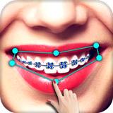 Braces आइकन