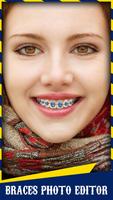 Braces পোস্টার