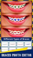 Braces স্ক্রিনশট 3