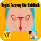 How To Restore Your Vaginal Size After Birth Easil icône