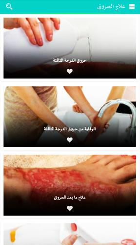 علاج الحروق For Android Apk Download