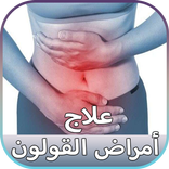 علاج القولون العصبي مجرب