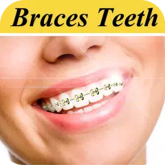 Braces Photo Editor