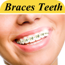 Braces Photo Editor APK