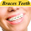 Braces Photo Editor