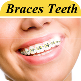 Braces Photo Editor-icoon