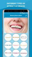 Braces Photo Editor اسکرین شاٹ 1