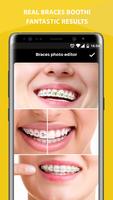 Braces Photo Editor اسکرین شاٹ 2