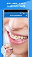 Braces Photo Editor اسکرین شاٹ 3