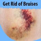 Get Rid of Bruises icône