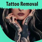 Tattoo Removal icône