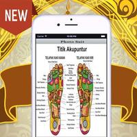 Akupuntur App bài đăng