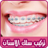 تركيب سلك الاسنان على صورك 😍