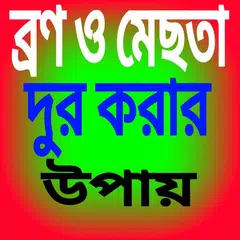 ব্রন ও মেছতার  দাগ দুর করার উপায় APK 下載