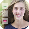 Braces Teeth Booth Camera