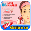Natural Tips For Acne APK
