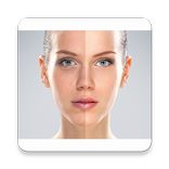 Acne Remover Photo Editor