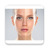 Acne Remover Photo Editor أيقونة