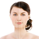 Pimple Remover biểu tượng