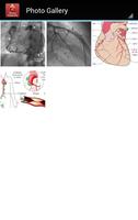 Coronary Angiography - CIMS capture d'écran 2