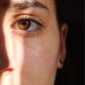 Rostro sin Acné (Solución)