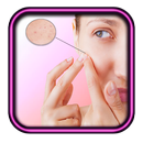 Pimple Remover Tips APK