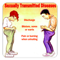 Std