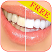 Teeth Cleaning tips