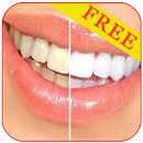 Teeth Cleaning tips APK