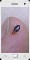 Bed Bugs poster
