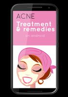 Acne Treatment and Remedies पोस्टर