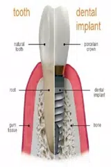 Скачать Лечение зубов APK