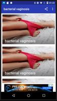 bacterial vaginosis 포스터