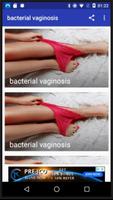 bacterial vaginosis poster