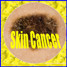 Skin Cancer biểu tượng