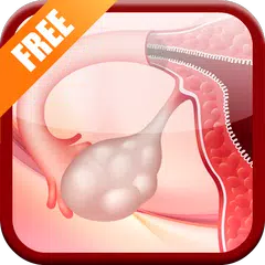 Polycystic Ovaries PCOS APK Herunterladen