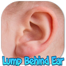 Lump Behind Ear APK