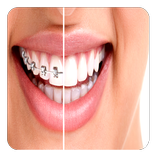 Orthodontic Guide