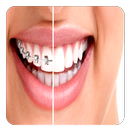 Orthodontic Guide APK