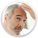 Baldness Tips APK